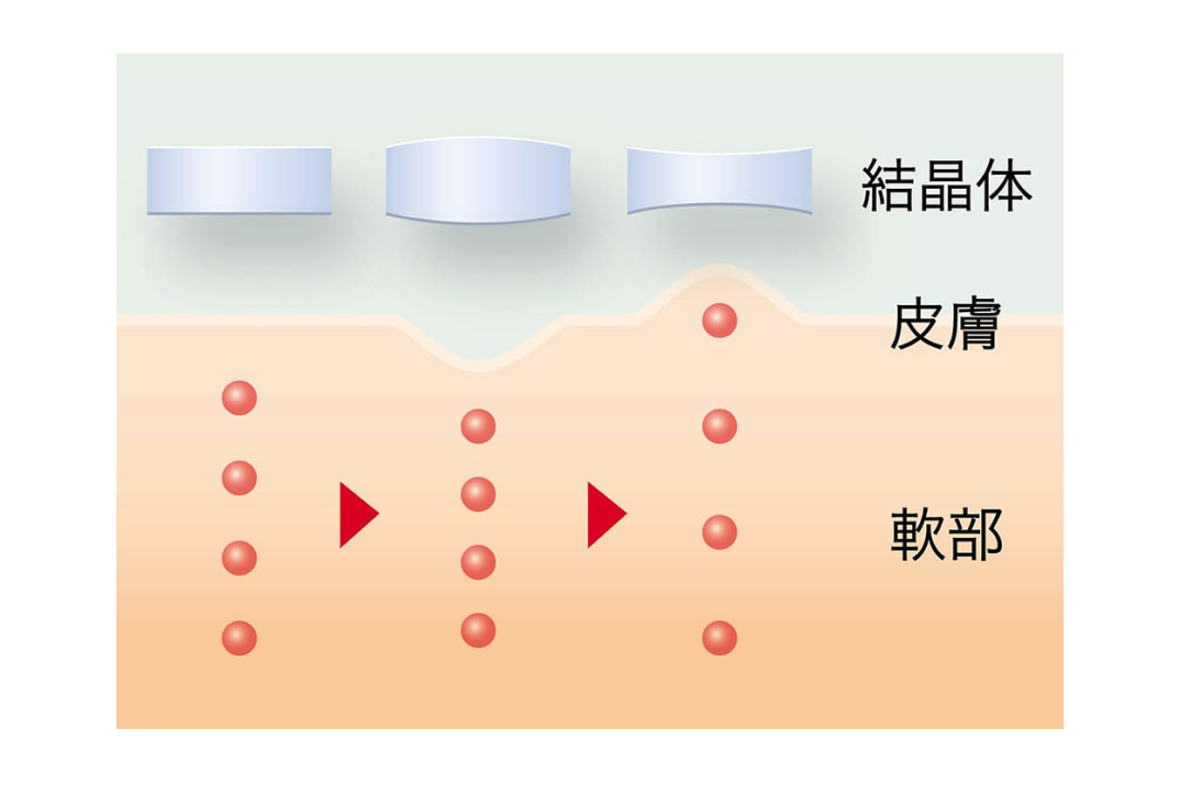 イメージ図:1秒間に数百万回のミクロマッサージ効果