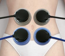 6極吸引導子を用いた治療例：腹部