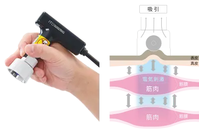 3Dリリースプローブ