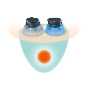 3D治療