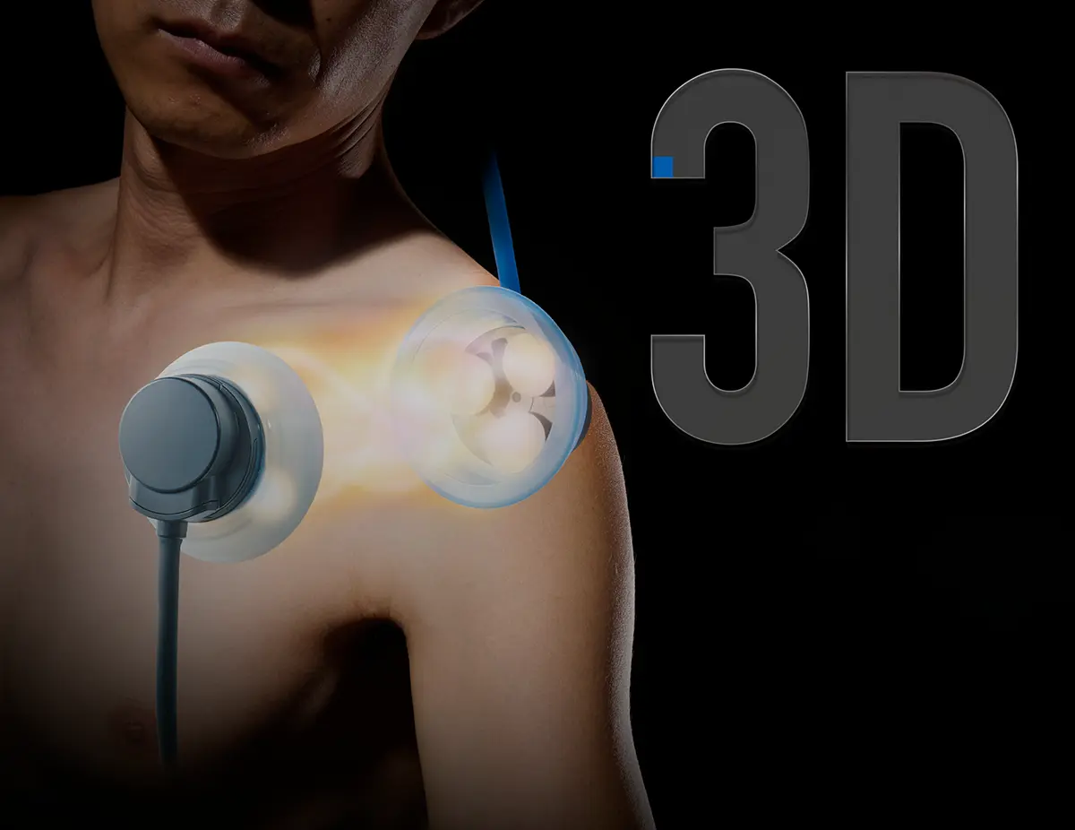 イメージ図：3D治療モード