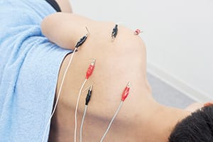 鍼電極の治療例：肩・背中