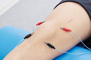 鍼電極の治療例：膝