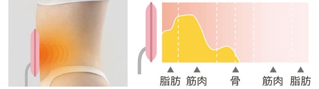 パッド型コイル導子の作用イメージ